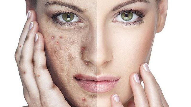 Picture for category Face Care